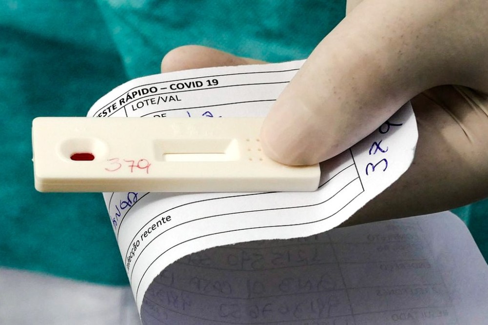 Em 24h, MS registra 1,1 mil casos positivos de Covid-19