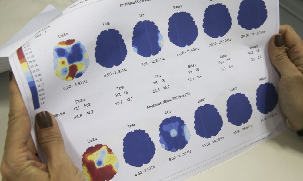 Março Roxo conscientiza população sobre a epilepsia