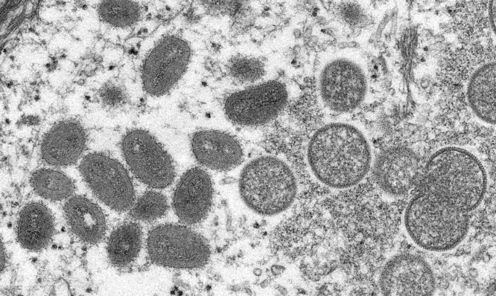 Saúde monitora 7 casos suspeitos de varíola dos macacos