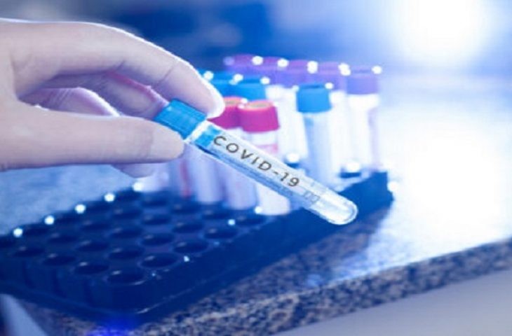 Boletim Covid-19 aponta mais 17 óbitos e 871 novos casos em MS