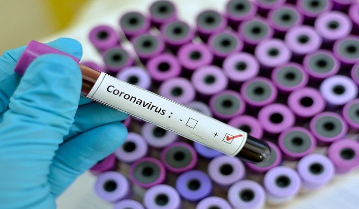 Ponta Porã tem semana com 2 mortes e mais de 60 casos de Covid-19