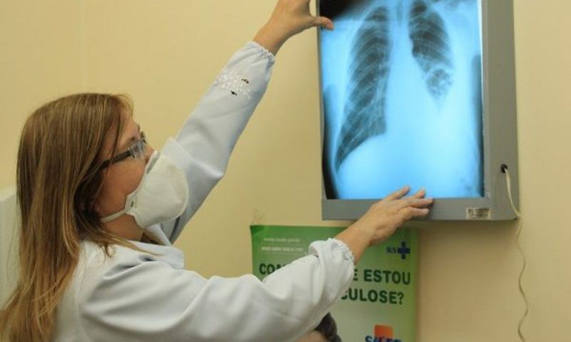 Dia Mundial de Combate à Tuberculose: saiba como prevenir e tratar a doença