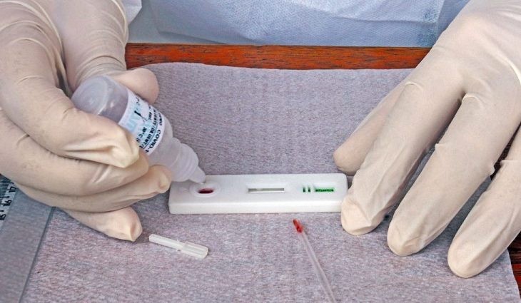 Mato Grosso do Sul registra 330 novos casos de covid-19 em 7 dias
