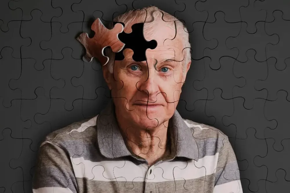 Alzheimer: brasileiros criam ferramenta que ajuda no tratamento