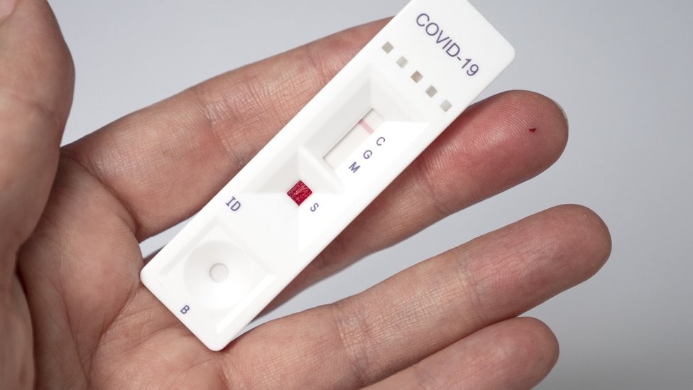 MS confirma 6 mortes e mais de 400 casos de Covid-19