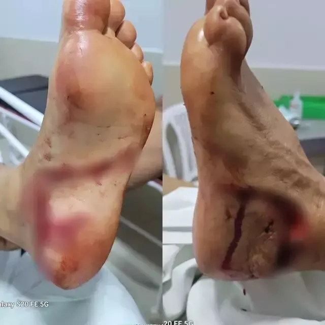 Turista é atacado por Dourado e tem cortes profundos em balneário de MS