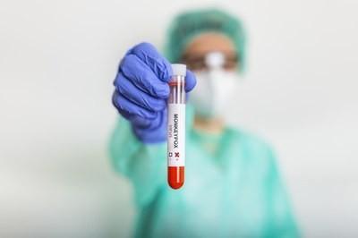 Mpox: OMS pede que fabricantes submetam vacinas para uso emergencial