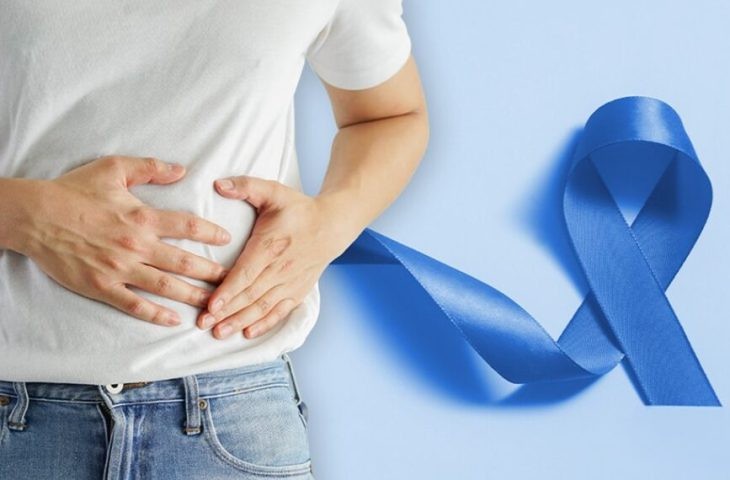 Rastreamento para câncer de intestino deve começar aos 45 anos, alerta SES