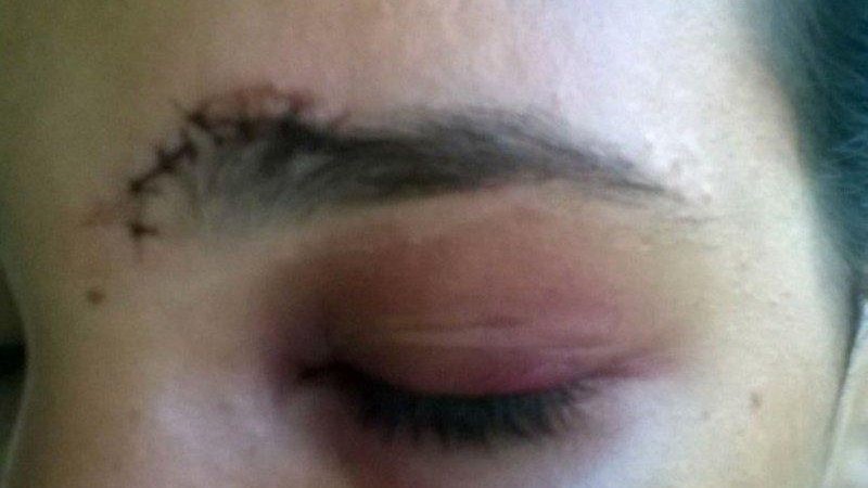 Mulher é agredida pelo esposo ao defender bebê de agressões