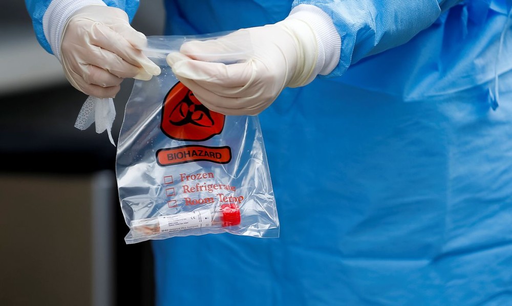 OMS pede colaboração para investigar origens do Novo Coronavírus