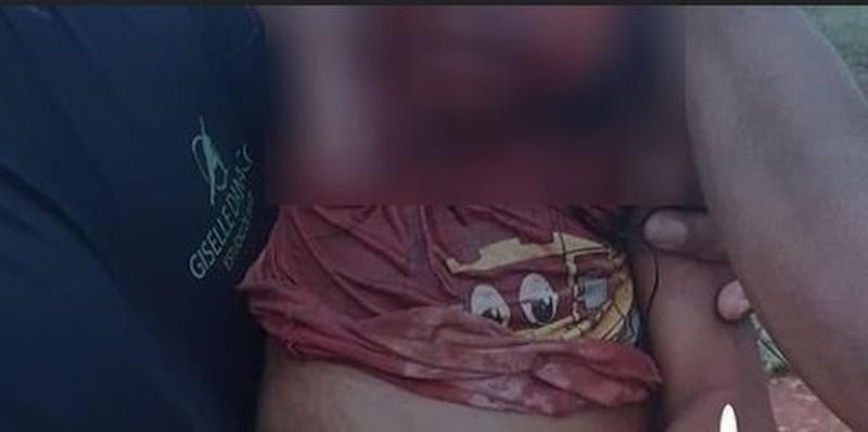 Criança fica ferida ao ser atacada por cão em aldeia